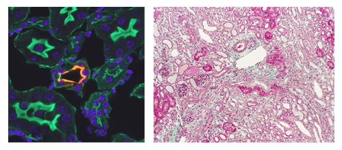 Renin-angiotensin system (RAS) biology images