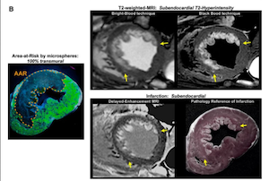 Imaging of at risk areas