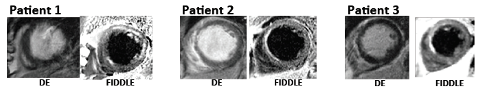 Example of FIDDLE