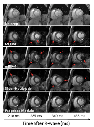 Example of T2