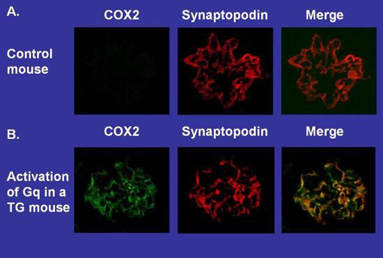 GPCR signaling in podocytes image