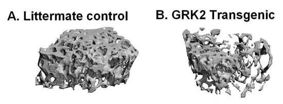 GPCR signaling in bone metabolism image