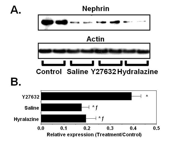 GPCR signaling in podocyte injury image