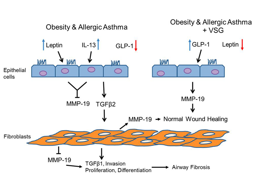 Obesity and Allergic Asthma