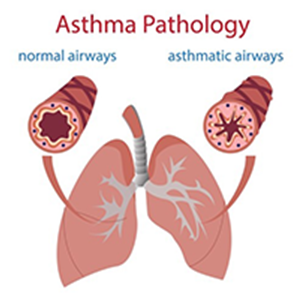 Asthma Pathology