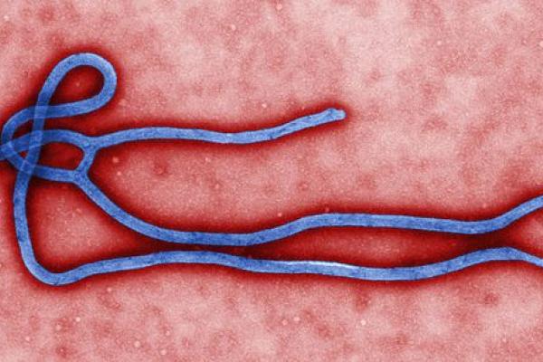Ebola virus