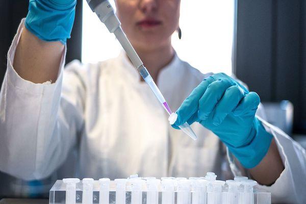 Post doc in lab
