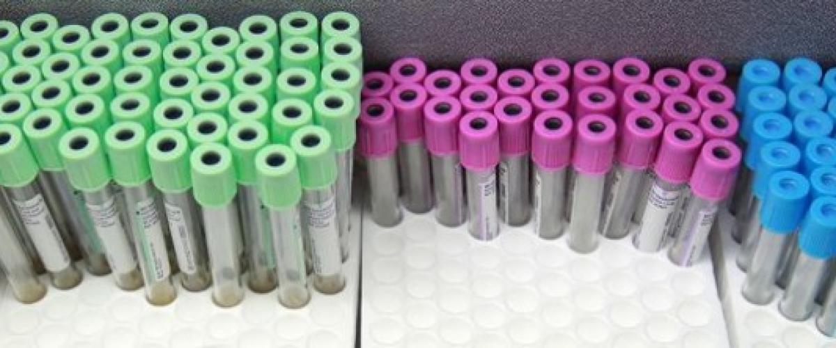 Vials